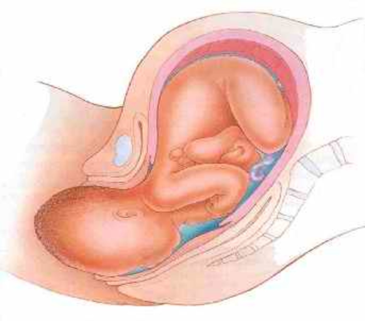 The transition phase of the stages of labor is normally the hardest phase to have to go through.  This picture shows the end of the transition phase of stage 1 and the beginning of stage 2 (birth of the baby).