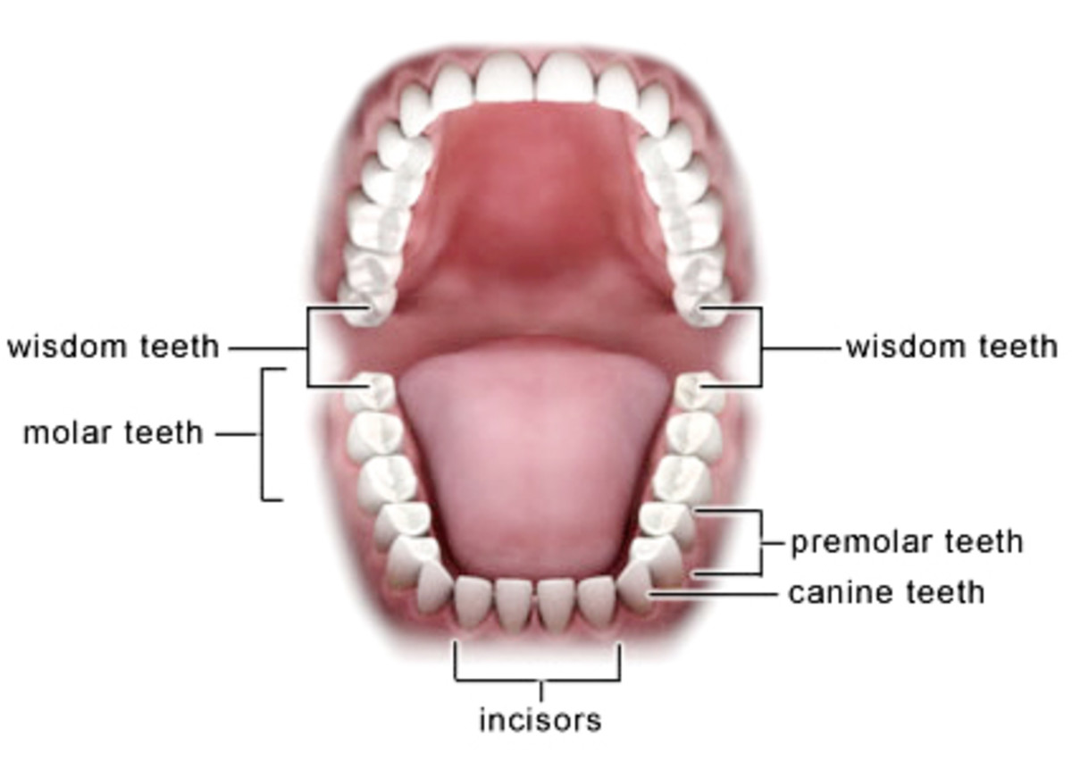 Wisdom Teeth: Preventing and Treating Infection