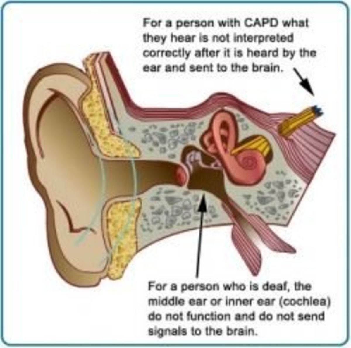 Information and Support for Central Auditory Processing Disorder (CAPD)