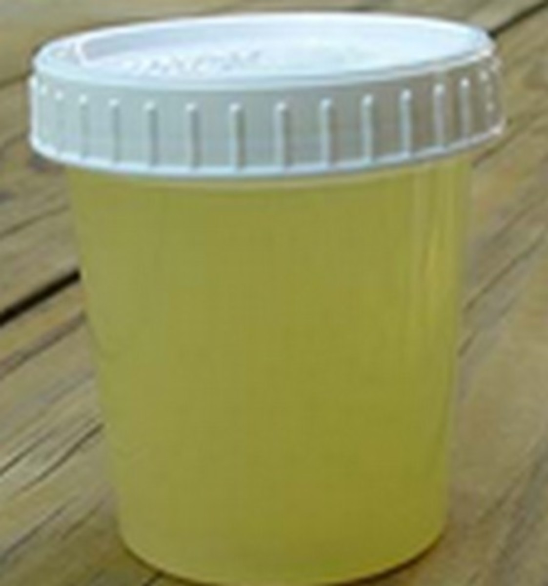 What Does Cloudy Urine Mean?