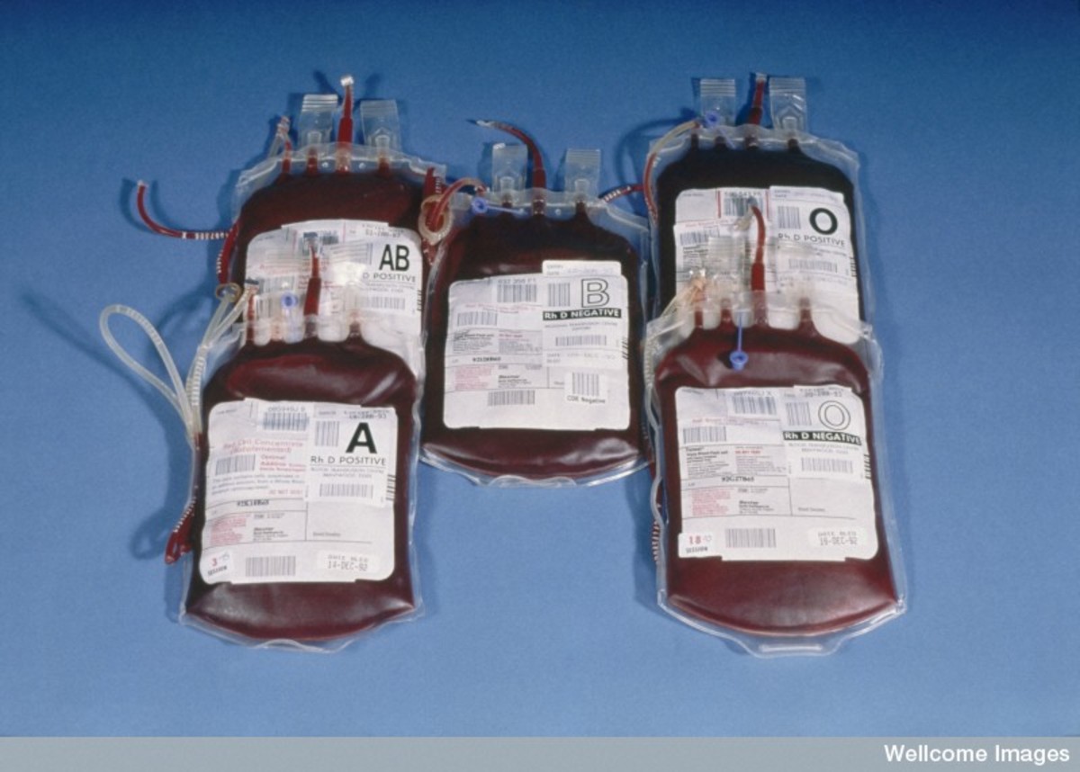 Blood transfusion bags with designated blood grouping