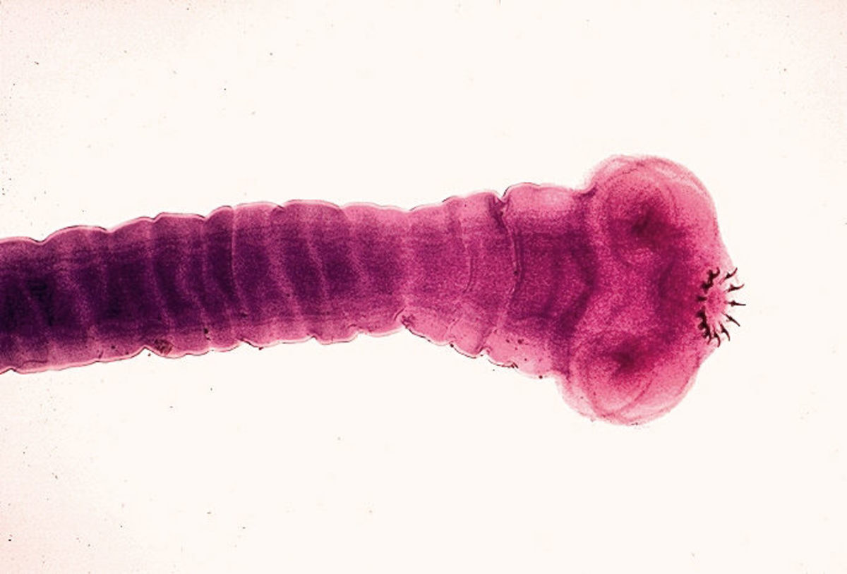 Tapeworm Symptoms, Treatment, And Prevention - HubPages