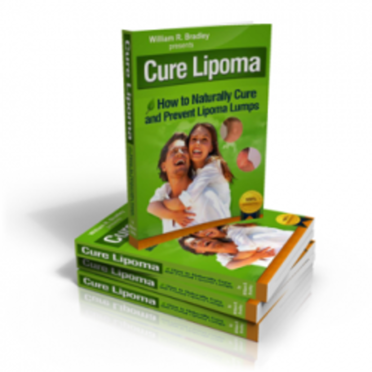 Cure Lipoma Naturally