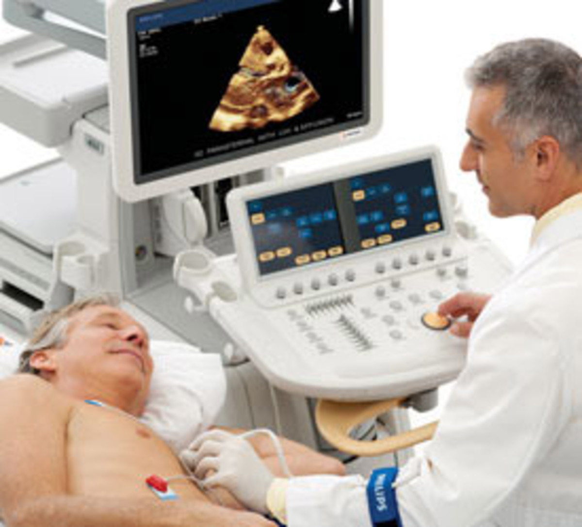 What To Expect From An Echocardiogram