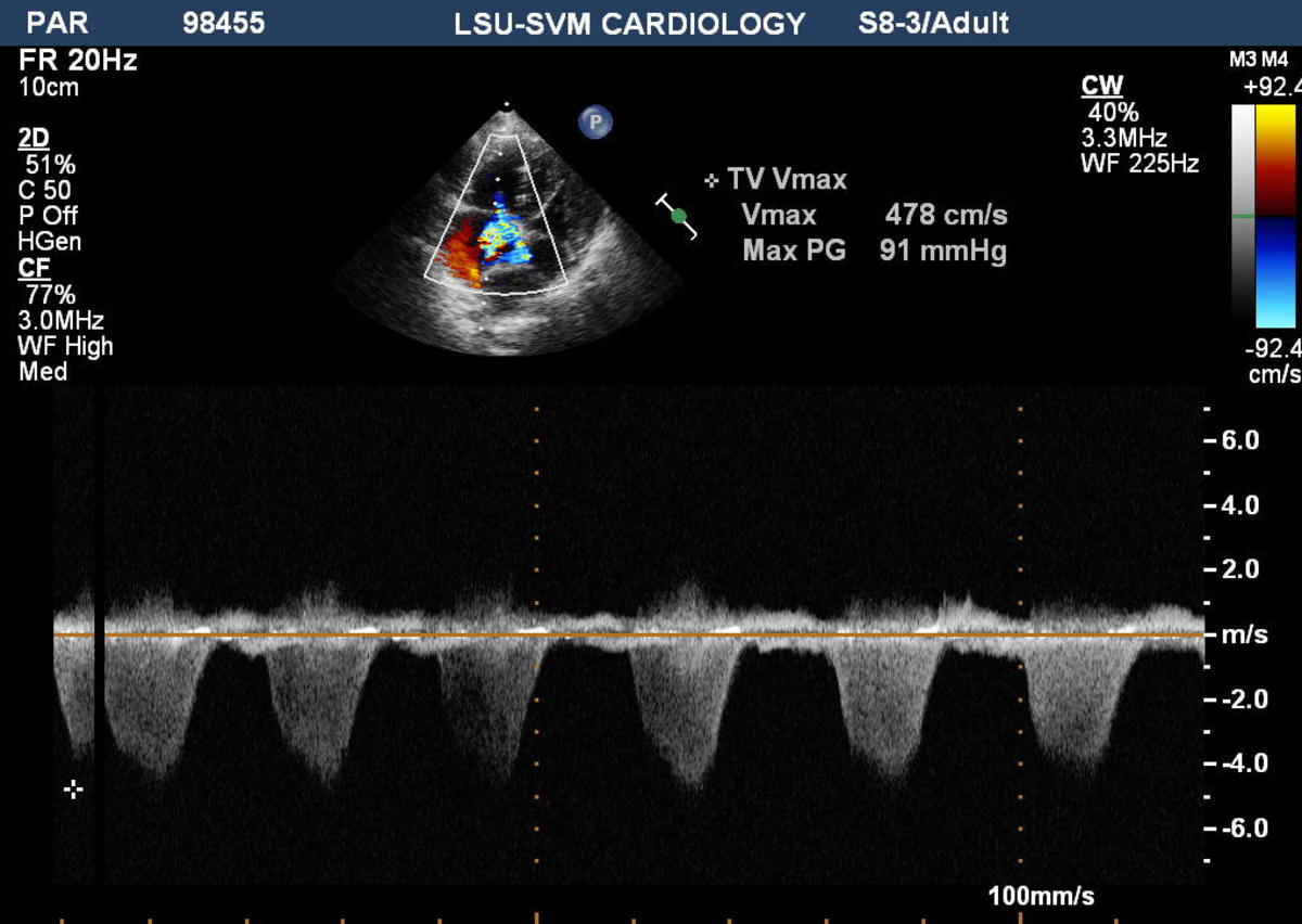 what-is-an-echocardiogram