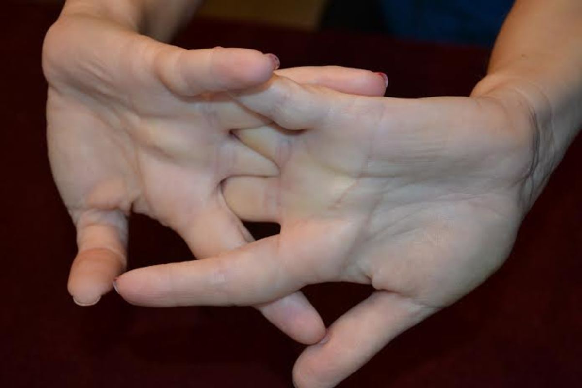 Reverse hand stretch will help to improve the circulation in your fingers and improve joint flexibility