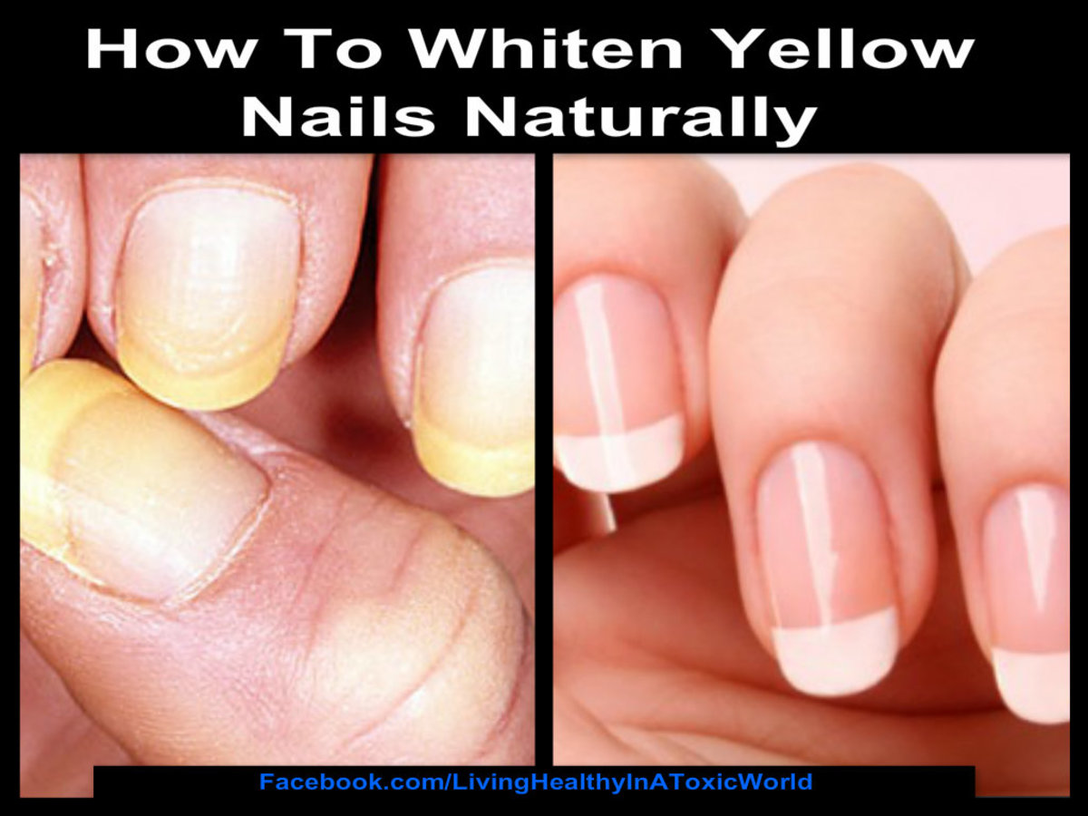 How To Whiten Yellow Nails Naturally