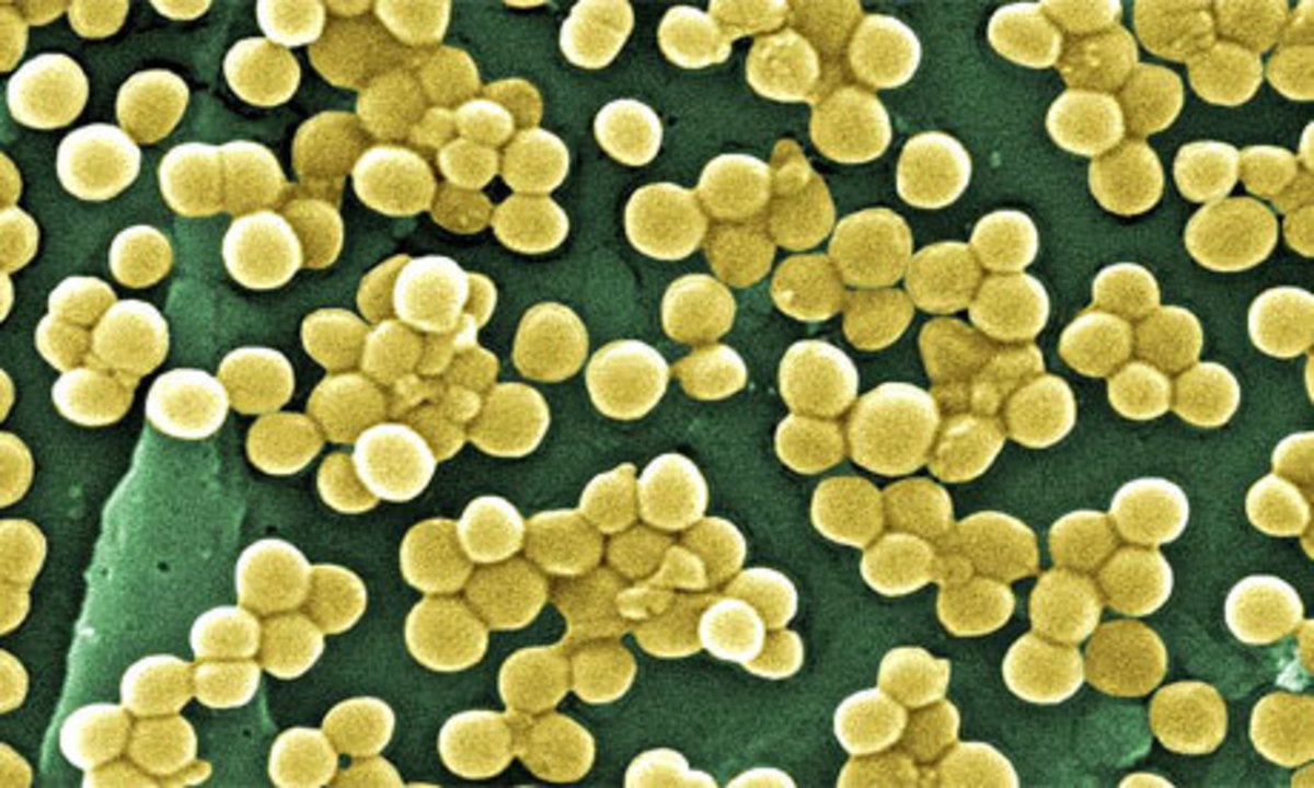 Methicylin-Resistant Staphylococcus Aureus