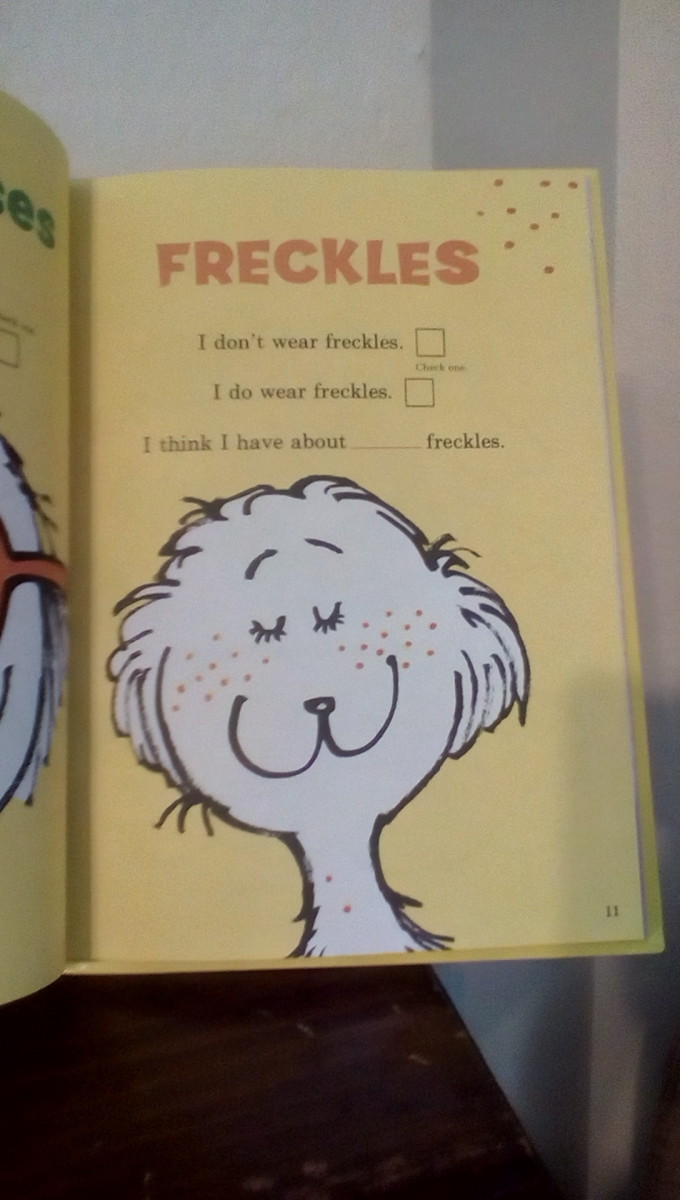 Do I have freckles?