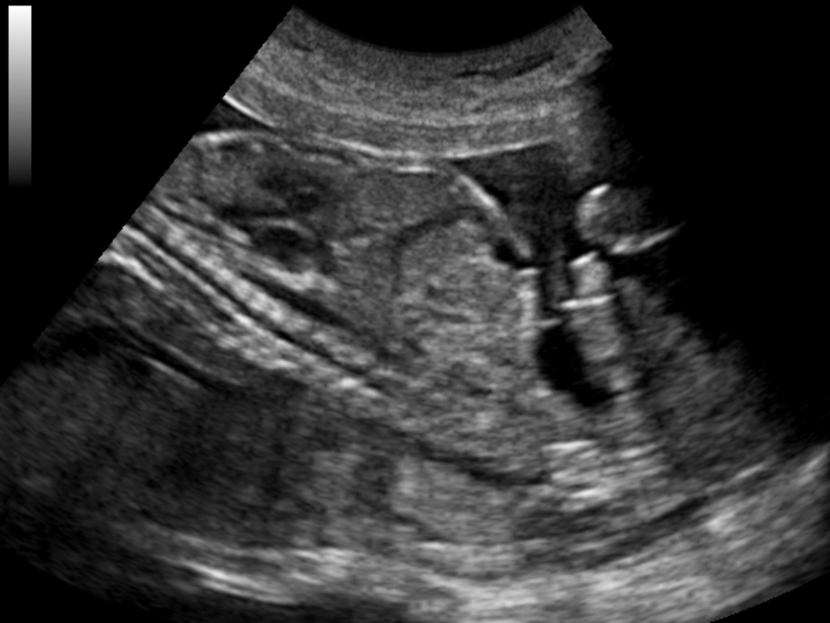 Ultrasound uses acoustic energy (sound waves) to asses both structure and function. 