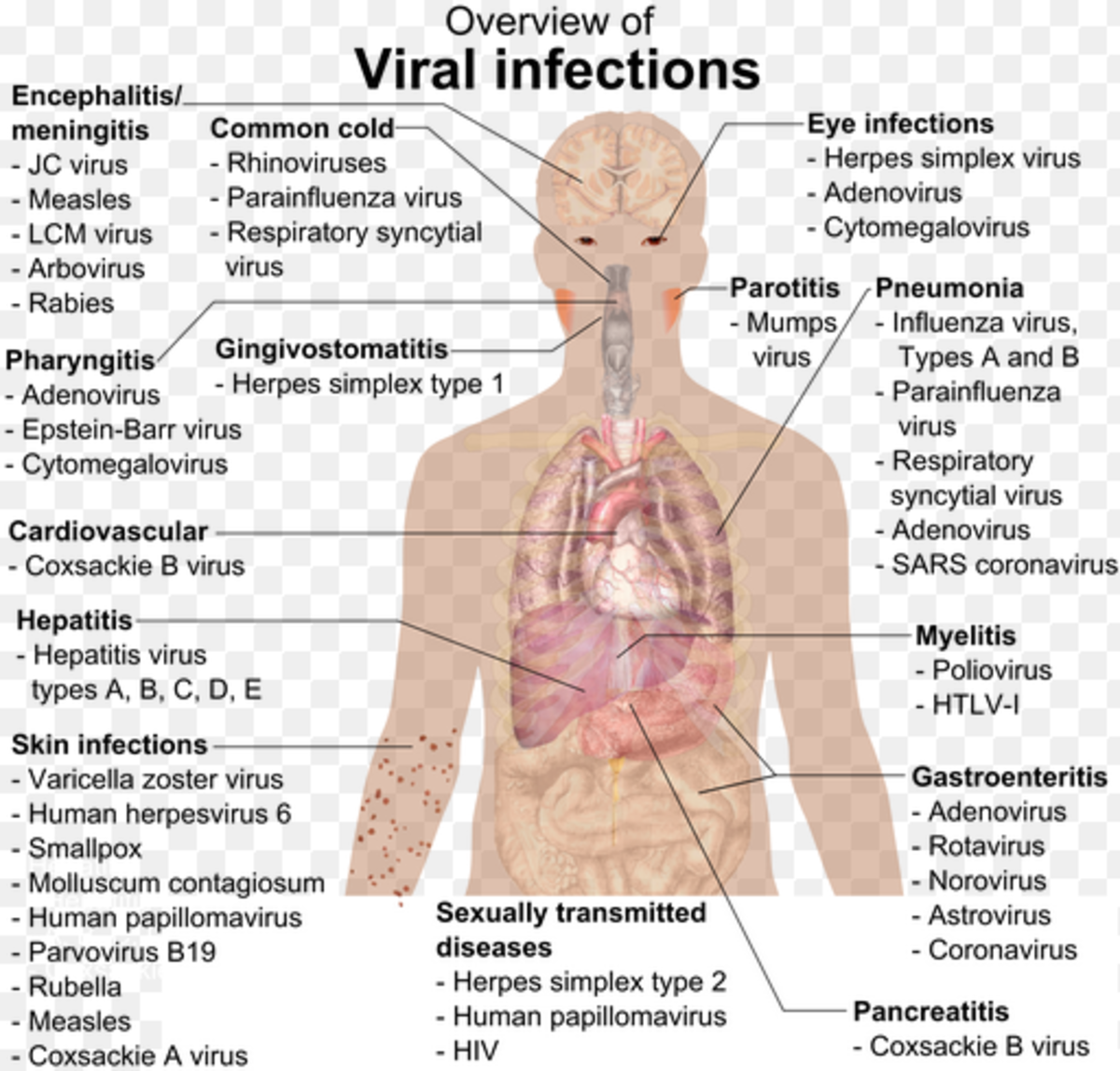 Flus and colds are just a couple types of viral infections.  