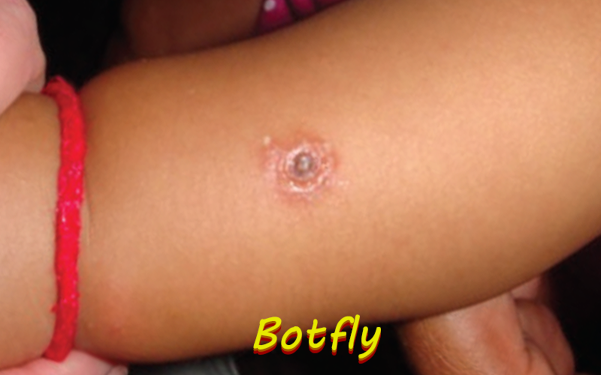 Botflies are found all over the world and lay their eggs under the skin of mammals.