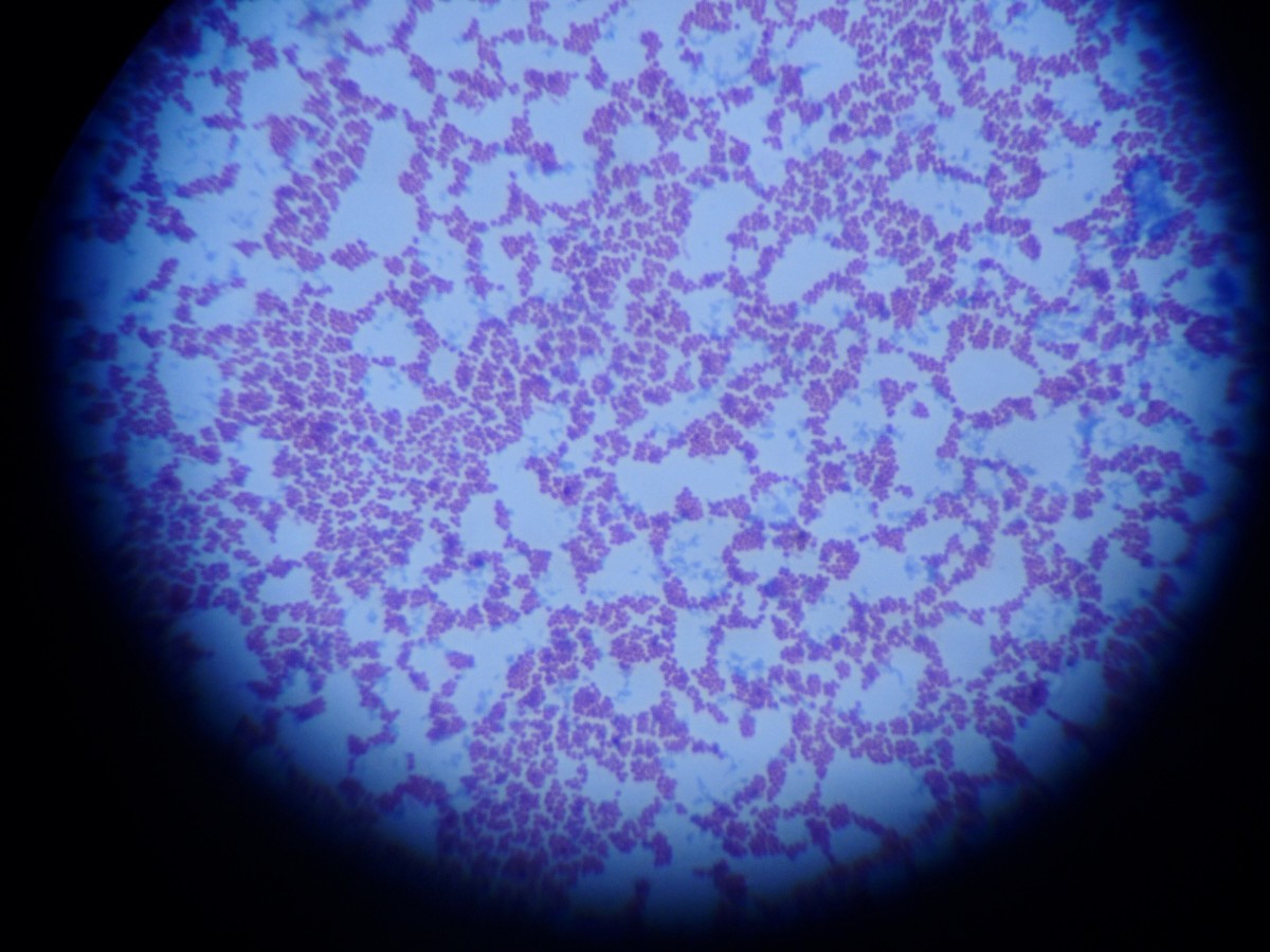Streptococcus Group B cells (stained)