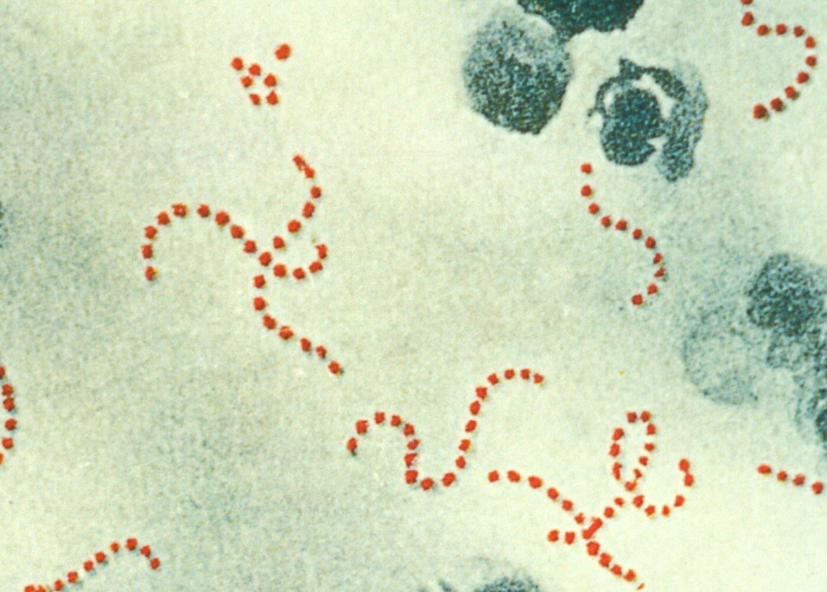 Streptococcus pyogenes cells (stained red) often join to form chains.