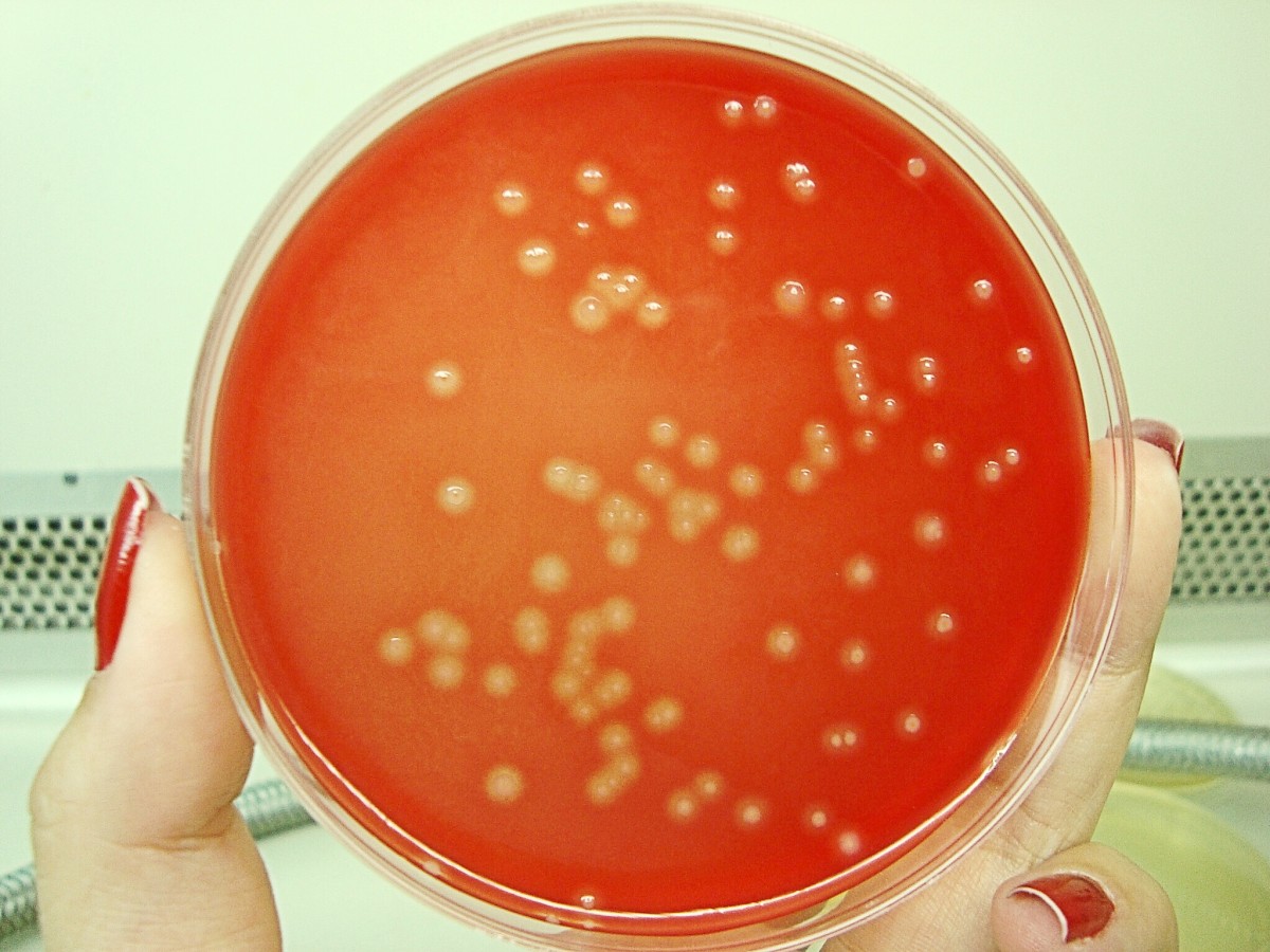 Streptococcus Bacteria In Groups A And B Facts And Diseases Youmemindbody