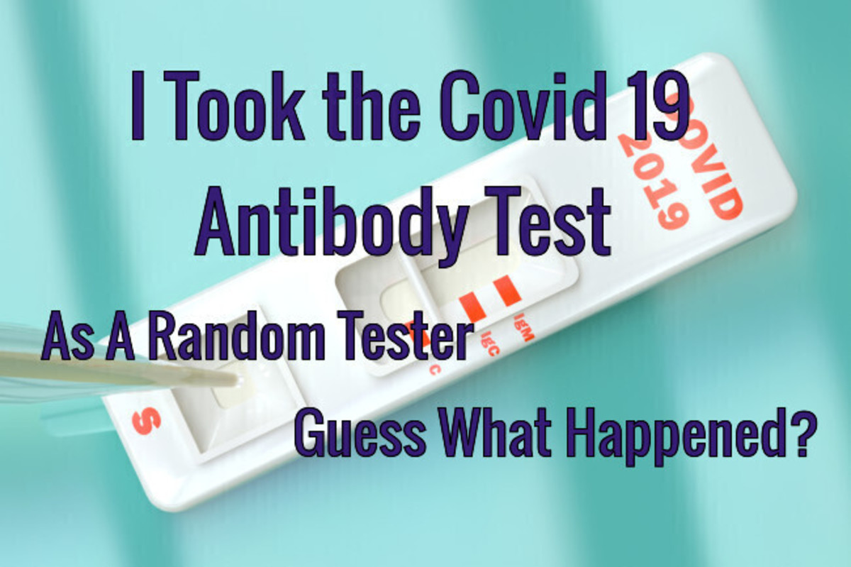 I Took the Covid 19 Antibody Test as a Random Tester Guess What Happened?