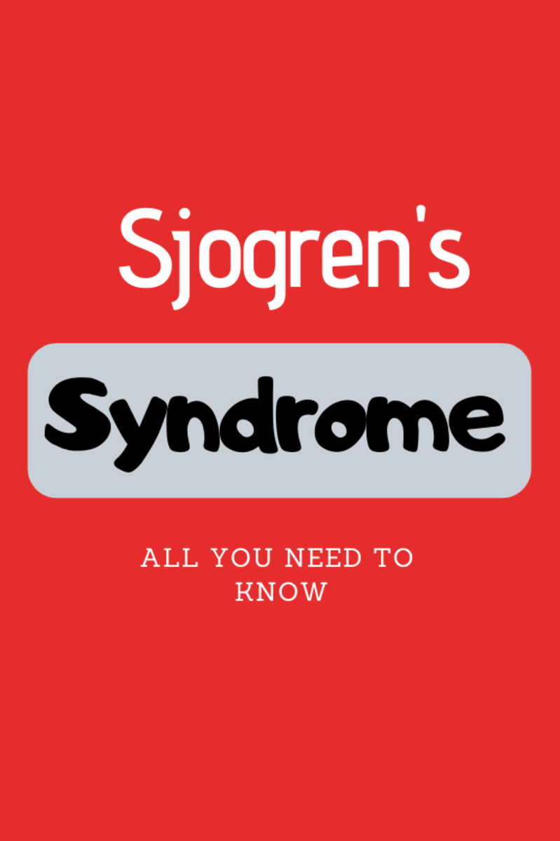 Sjogren’s Syndrome Symptoms, Cause, Diagnosis, Complications, Diet And ...