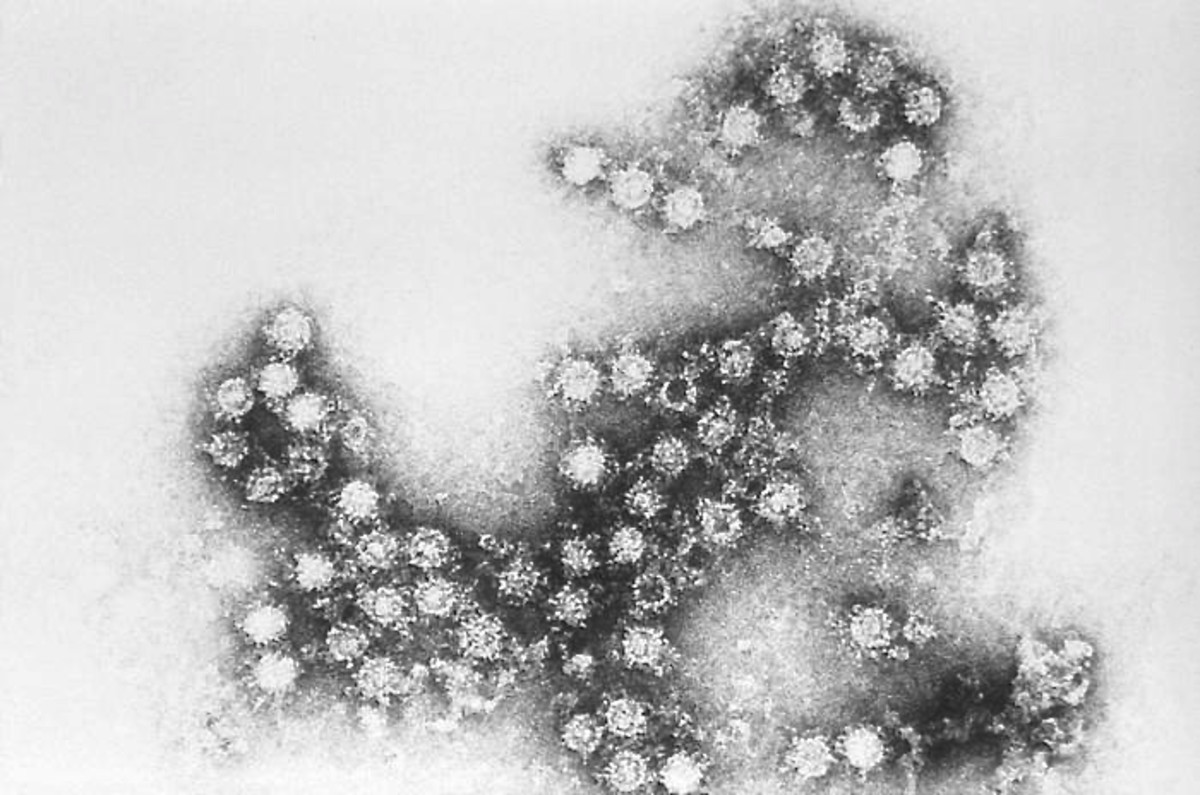 Coxsackievirus virions (individual virus particles)