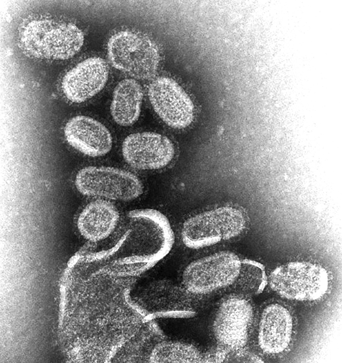 One type of influenza (flu) virus