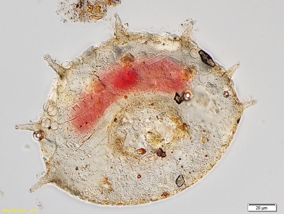 Centropyxis aculeata is an amoeboid protist found in damp soil around mosses and in the mud of ditches and lakes.