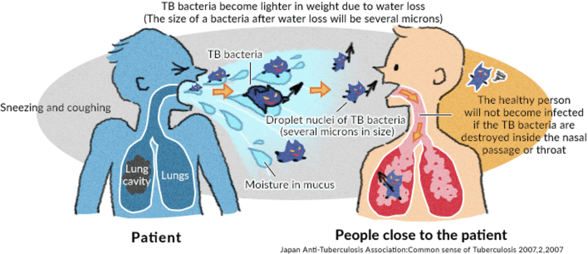 Tuberculosis and its types