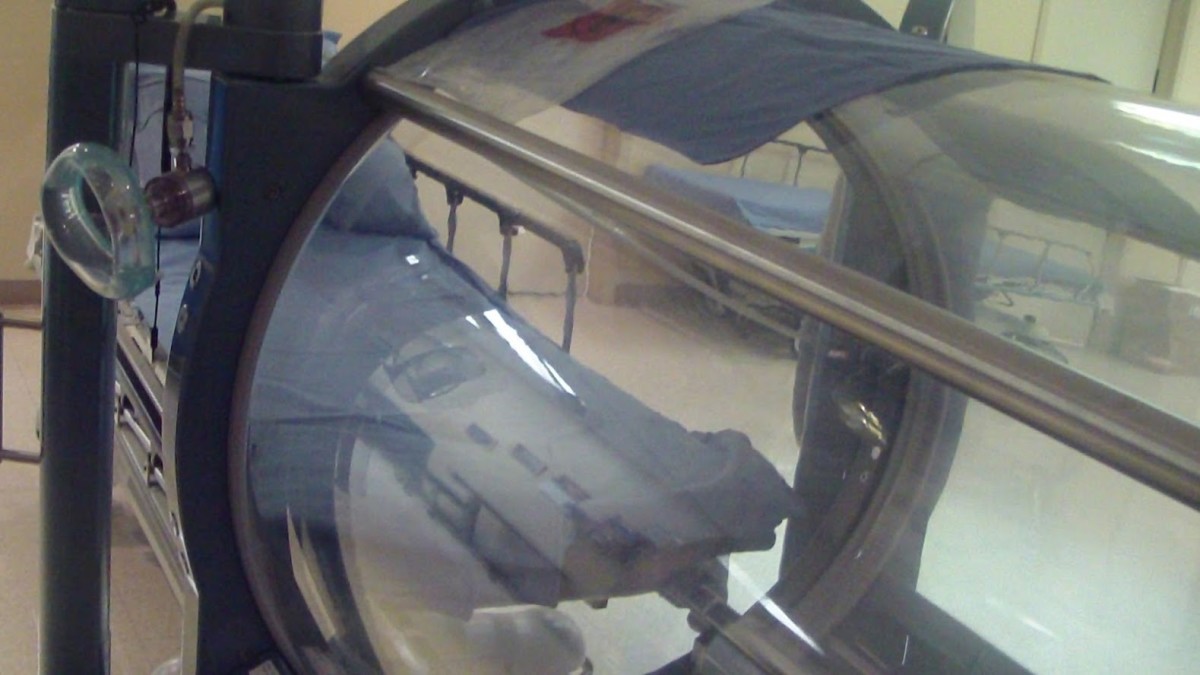 Hypobaric Chamber Therapy HubPages