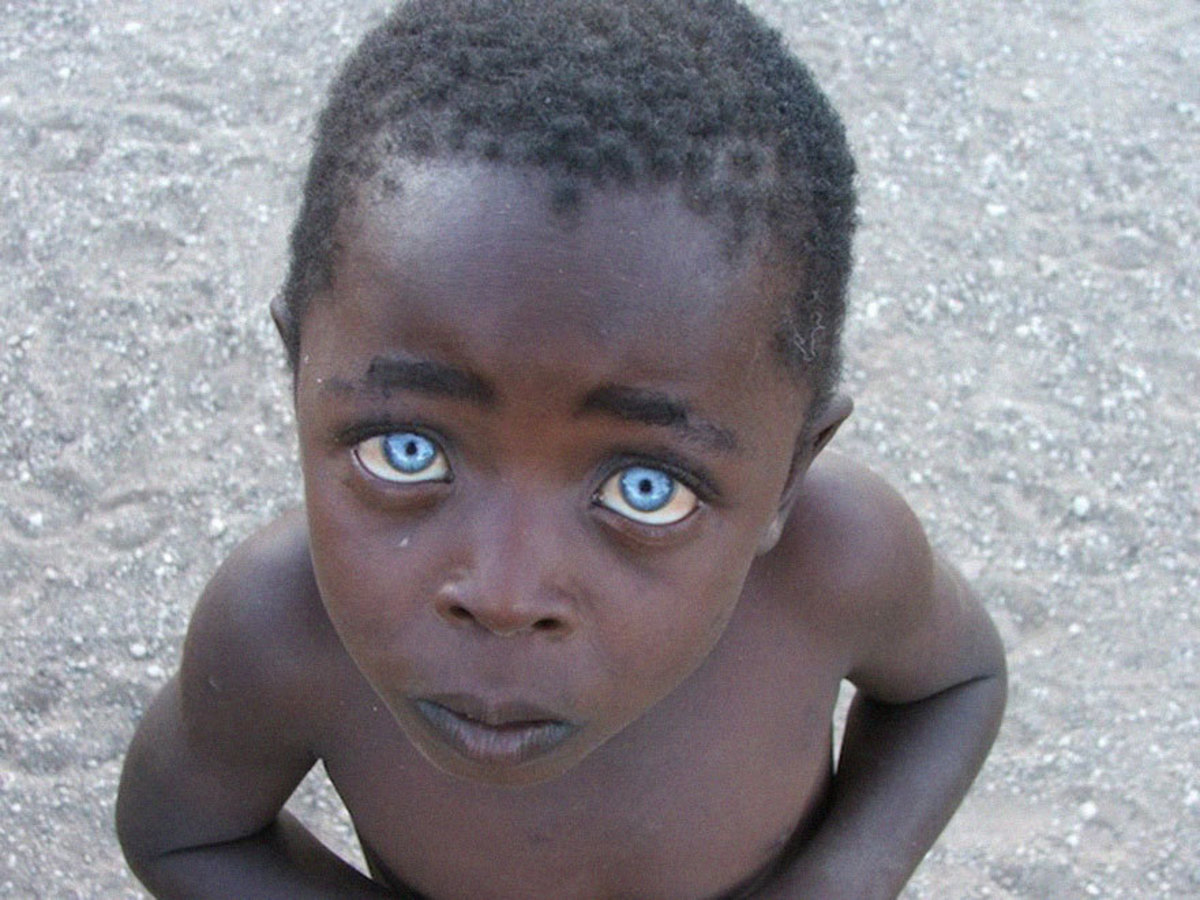 The picture is called The Boy with the Sapphire Eyes. As soon as photographer Vanessa Bristow posted it she was flooded with accusations of photoshop. She responded by posting other pictures of the boy as it is in fact not altered. The blue eyes and 