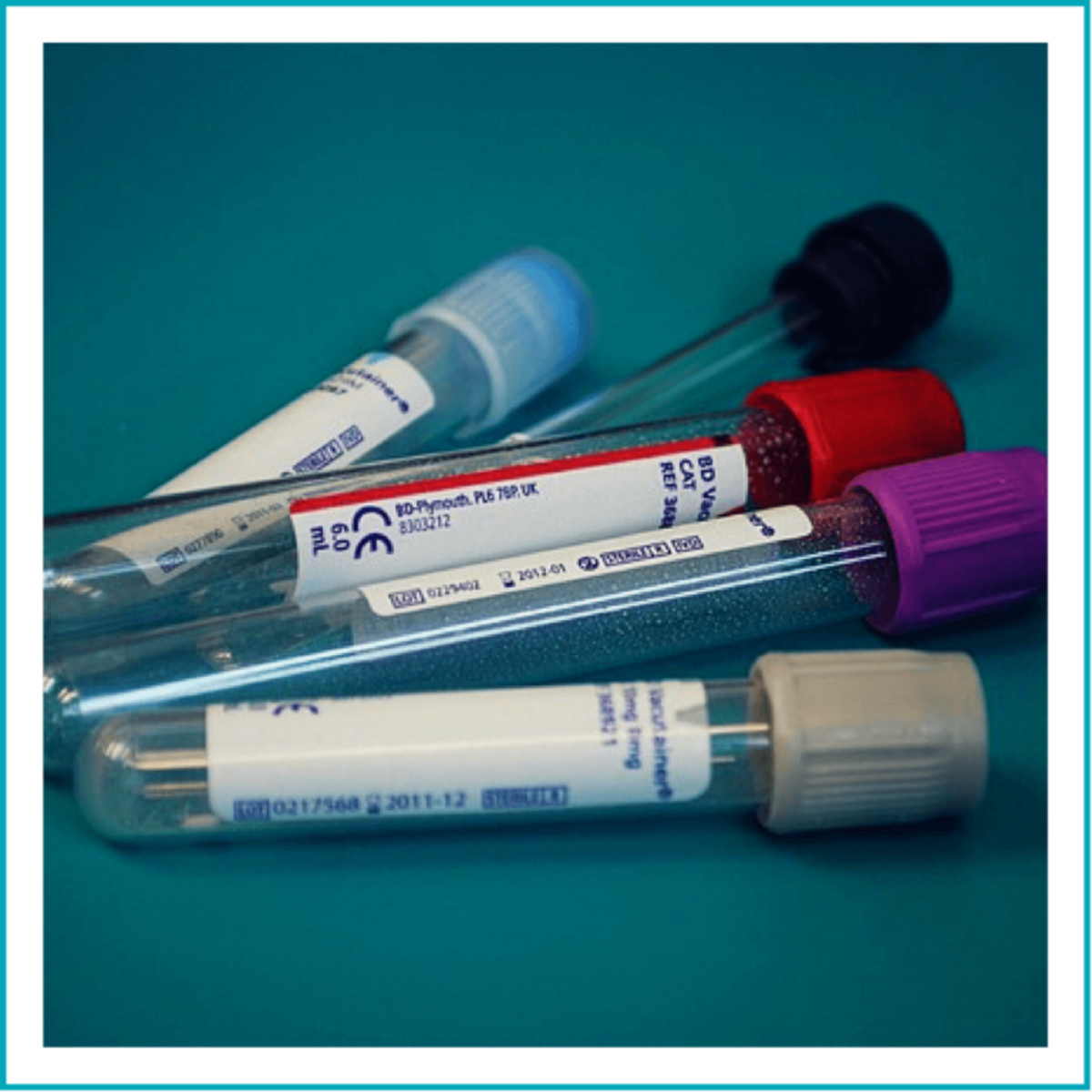 blood-sample-collection-pathology