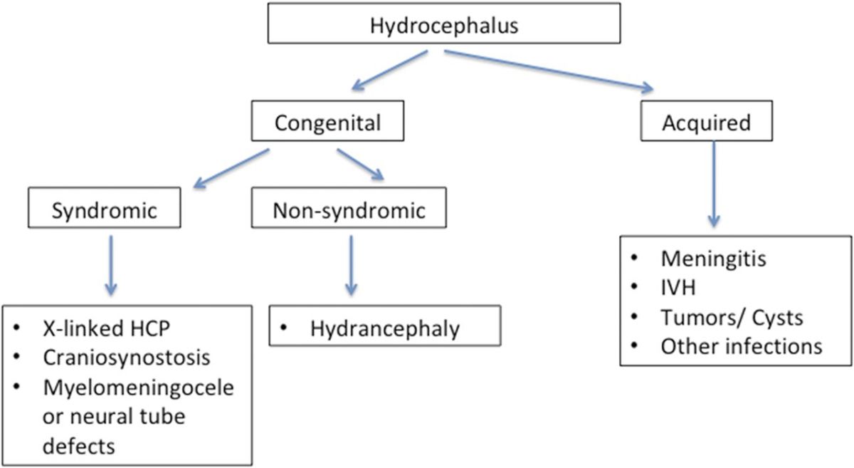 hydrocephalus-in-pediatrics