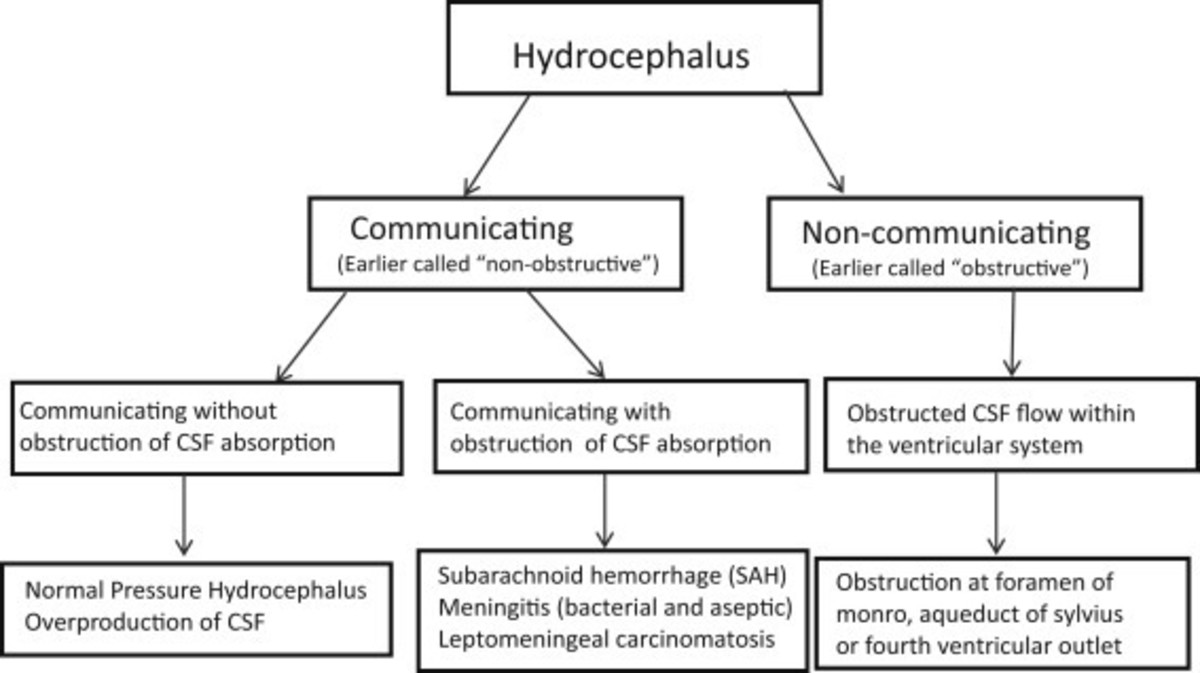 hydrocephalus-in-pediatrics