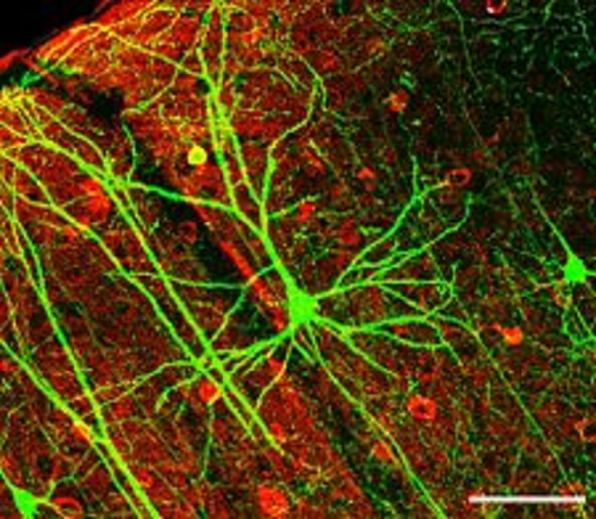 Dendrites and neurons in the hippocampus, which play a major role in learning and memory.