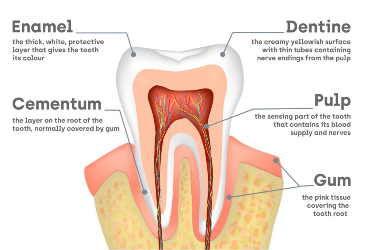 What Causes Sensitive Teeth Dental Care HubPages