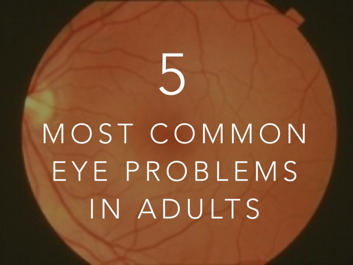 The Five Most Common Eye Problems in Adults