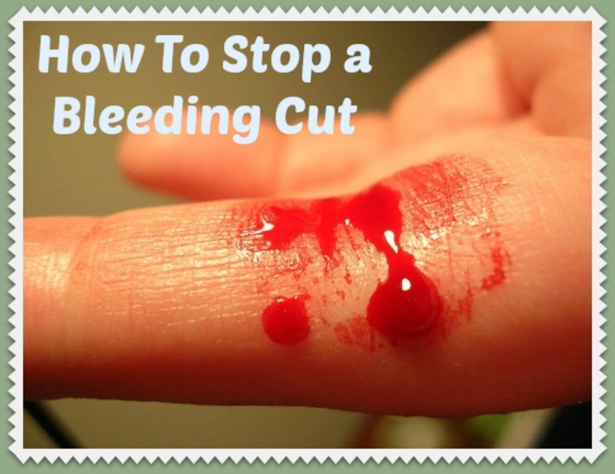 How To Stop a Bleeding Cut
