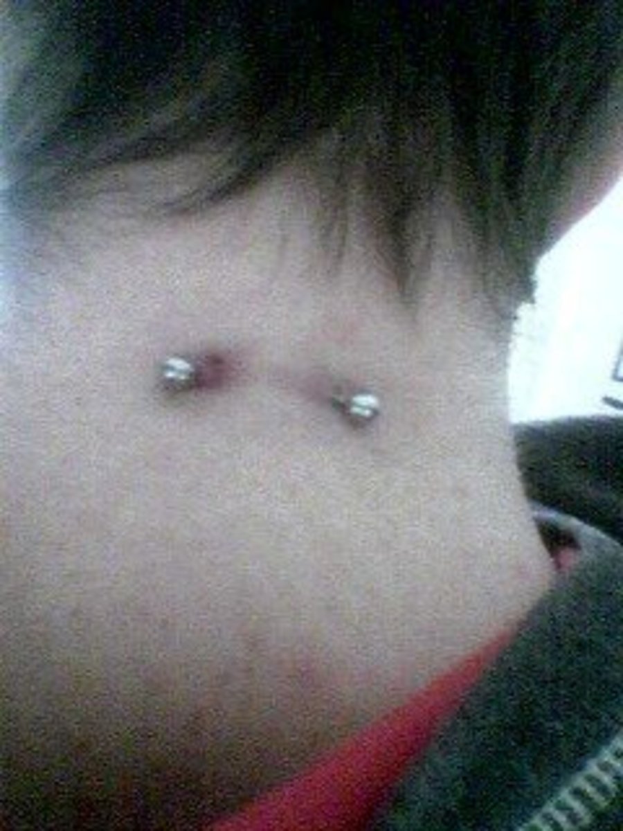 When a piercing isn't healing properly, it will be red, bruised and inflamed
