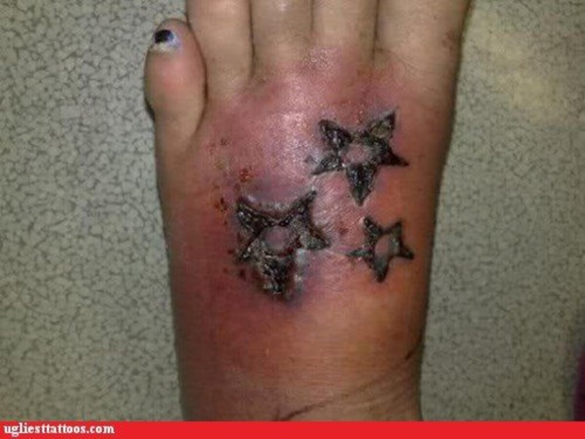 Infected and swollen tattoo on foot