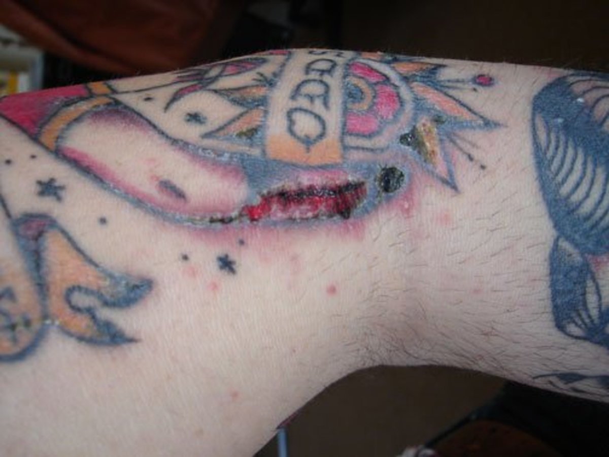 Is It Normal For A New Tattoo To Be Bruised  Psycho Tats