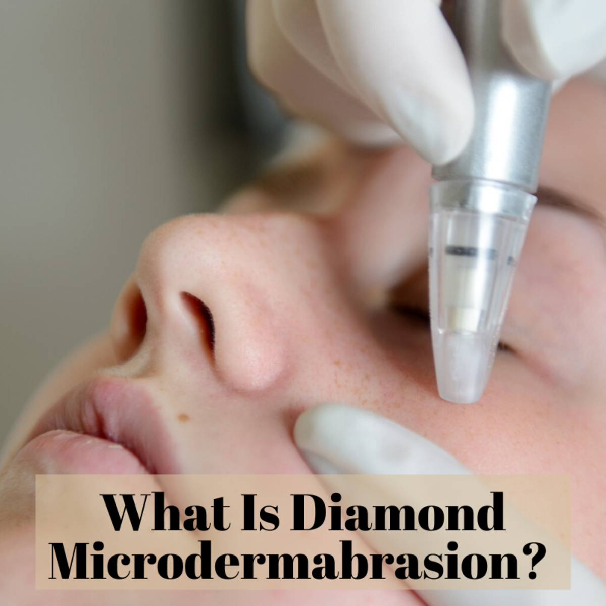 The Benefits of Diamond Microdermabrasion