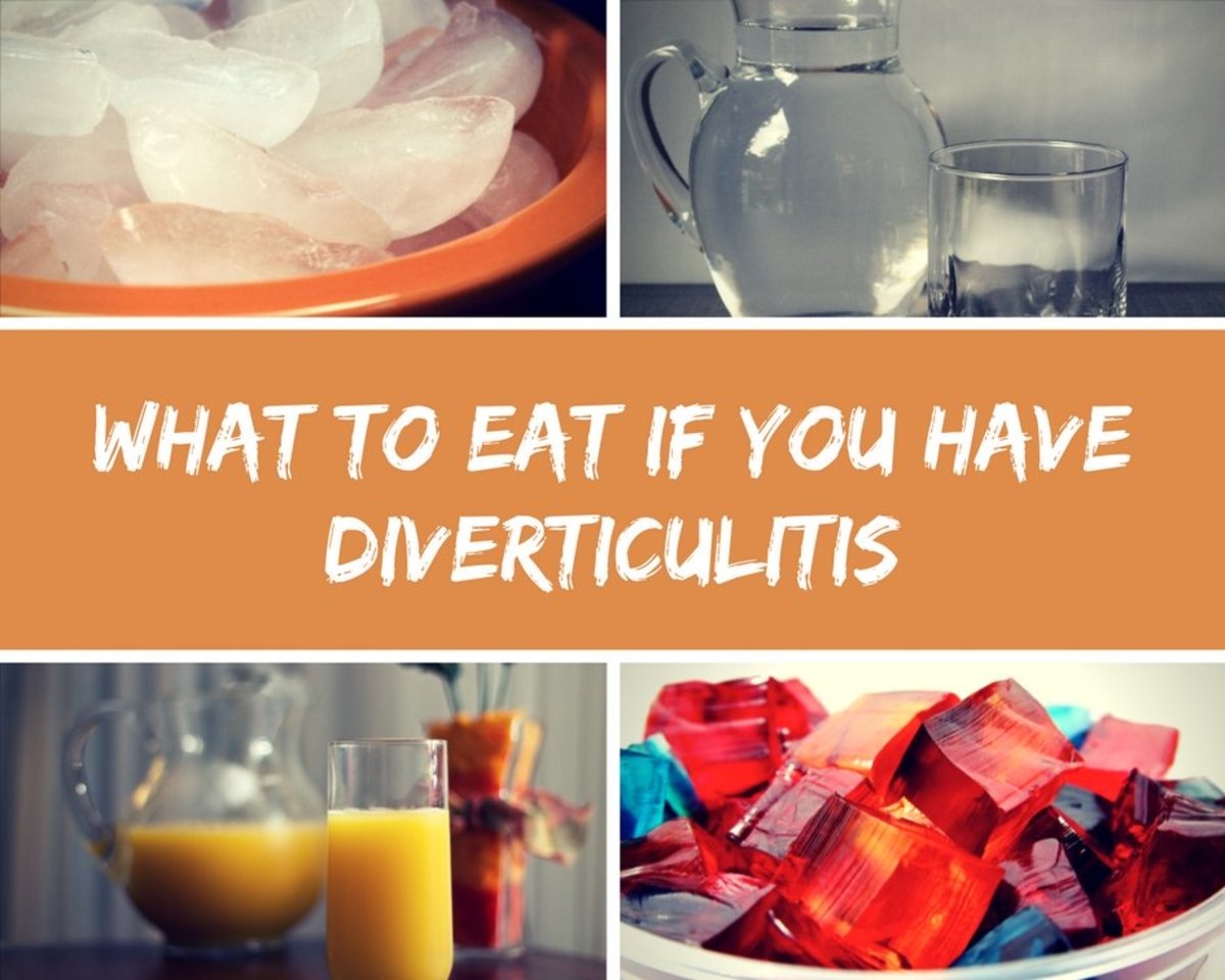 What Foods Can Trigger Diverticulitis Deporecipe co