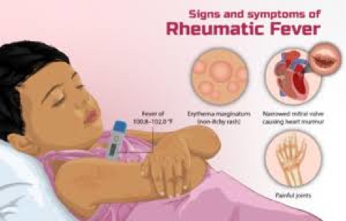 Rheumatic Heart Disease Levels Of Prevention HubPages