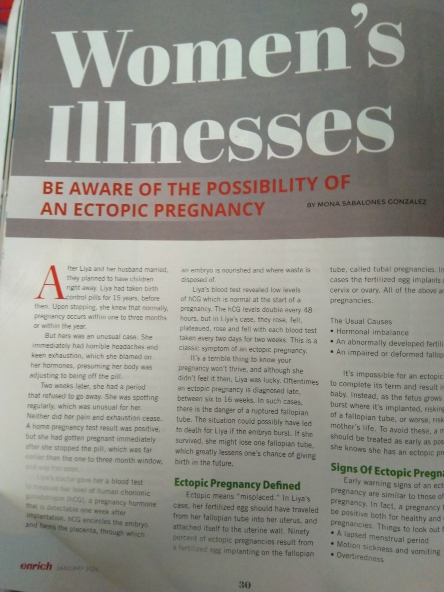 Women’s Illnesses: Be Aware of  the Possibility of an Ectopic Pregnancy