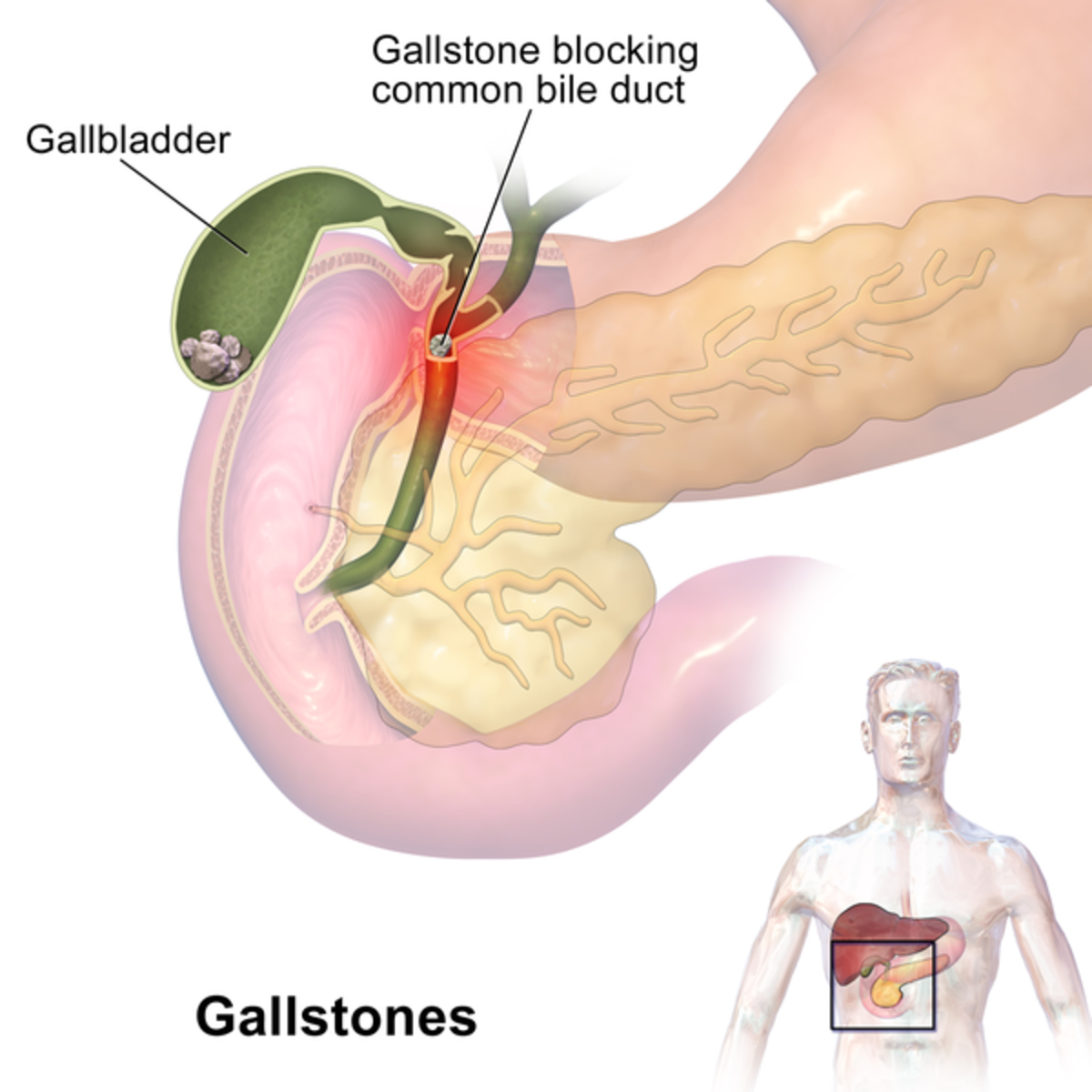 gallbladder-facts-and-experience