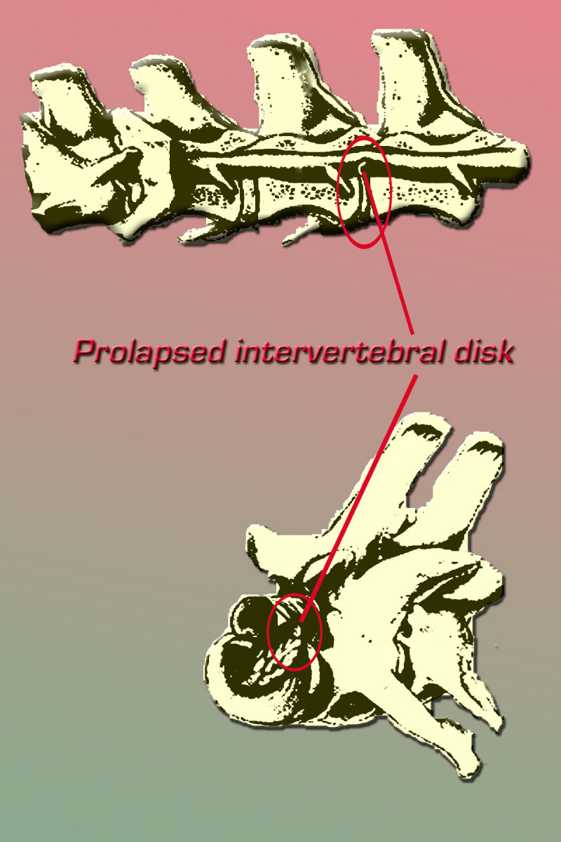 nervous-system-disorders-in-dogs-spinal-problems-in-dogs-hubpages