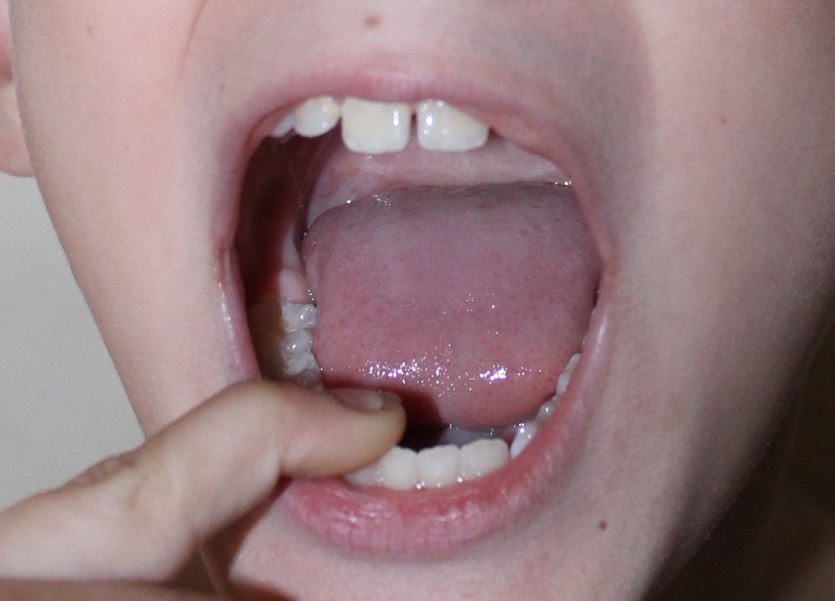 Mechanical digestion begins in the mouth.