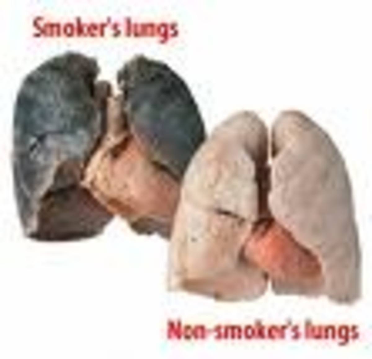 Smoker's Lungs and Non-Smoker's Lungs.