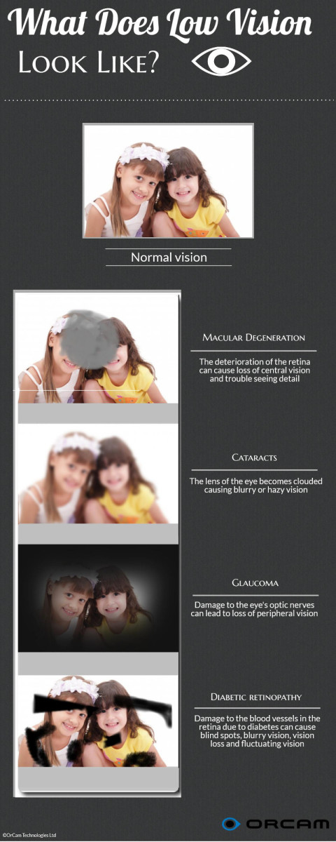 What Does Low Vision Look Like?