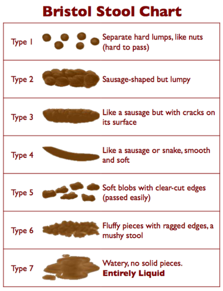 7 Types of Stool Shapes https://commons.wikimedia.org/wiki/File:BristolStoolChart.png