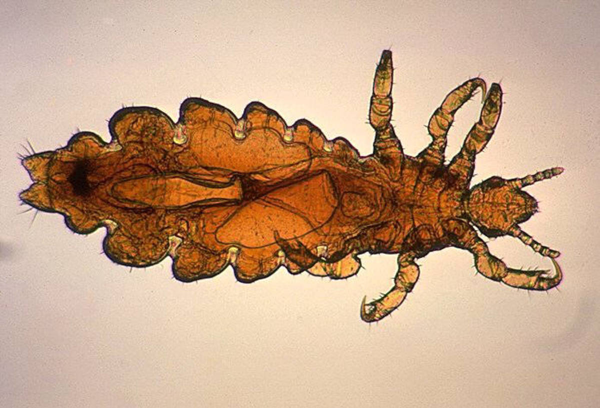 Picture of an adult head louse, magnified