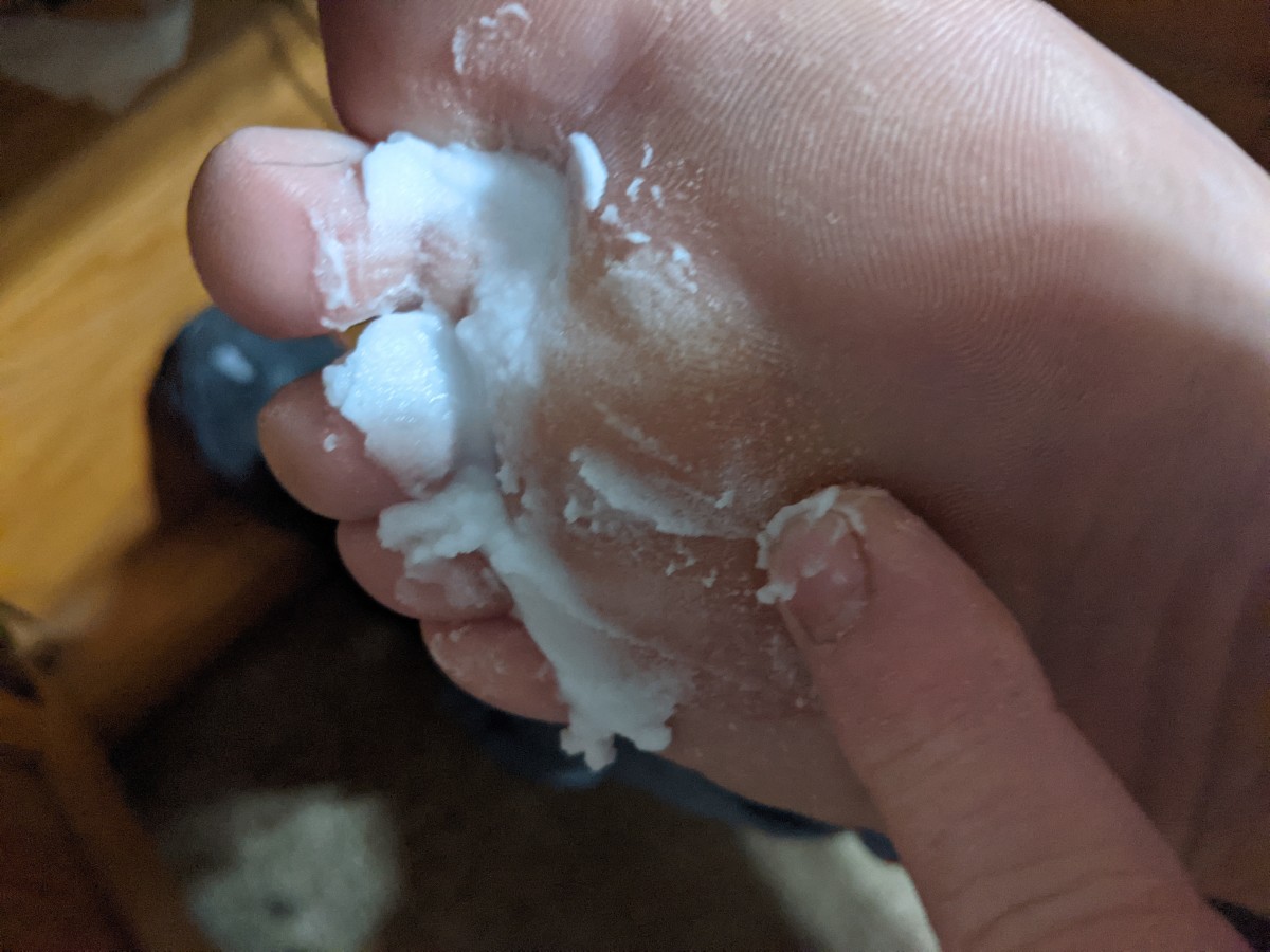 fungus-feet-using-baking-soda-paste-to-soothe