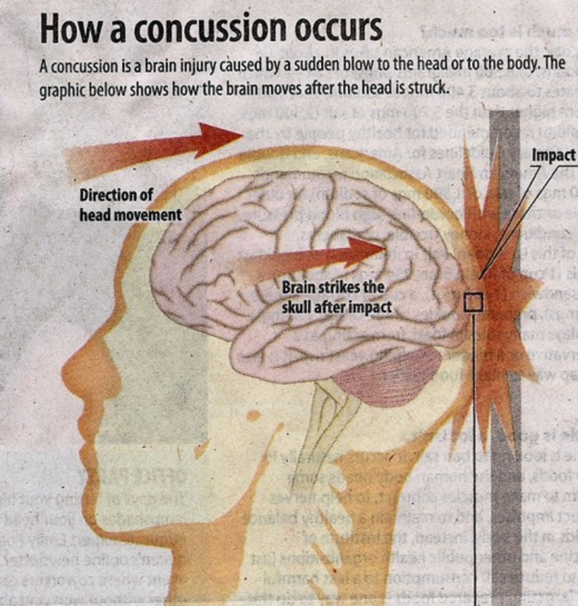 facts-of-traumatic-brain-injury